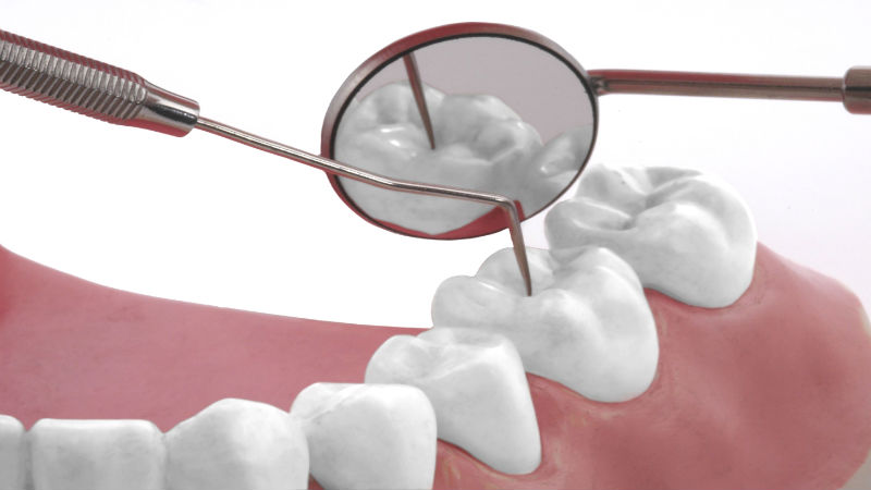 What To Bear In Mind When Choosing A Cosmetic Dentist