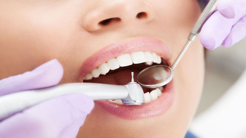 How Veneers Can Improve Your Smile
