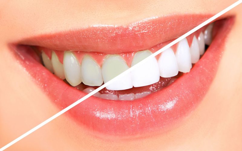 How to Know When to Schedule a Dental Appointment Outside Routine Exams