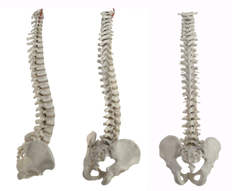 Spine Problems: What Can be Done?