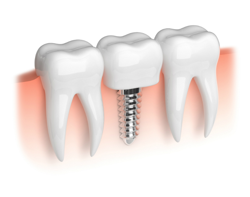 Let Cosmetic Dentistry Improve Your Overall Health and Appearance